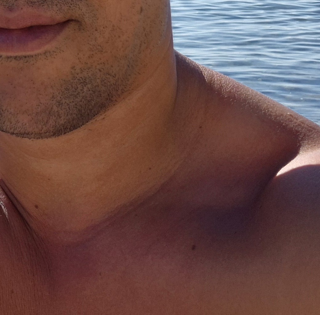 Perfil de Richardson